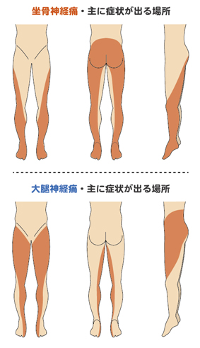 坐骨神経や大腿神経の身体の支配領域